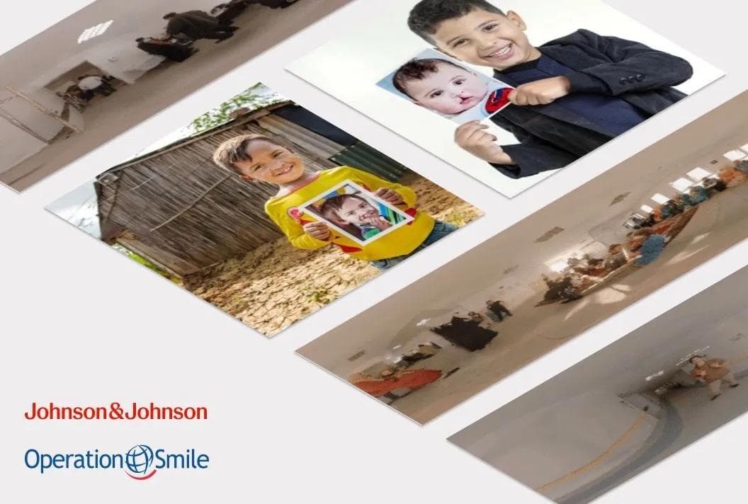 J&J Operation Smile project showcase